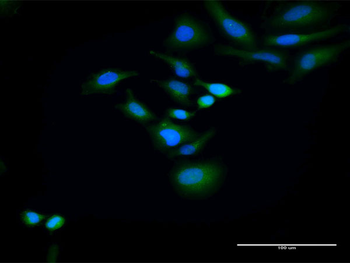 HOMER2 purified MaxPab rabbit polyclonal antibody (D01P)