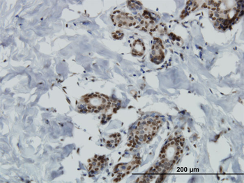 MAP4K4 monoclonal antibody (M07), clone 4A5