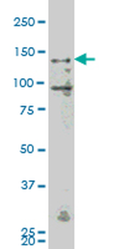 MAP4K4 monoclonal antibody (M07), clone 4A5