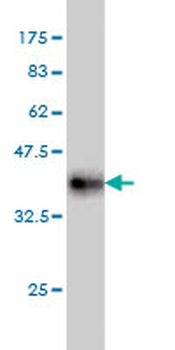 MAP4K4 monoclonal antibody (M07), clone 4A5