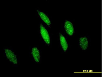 GSTO1 purified MaxPab mouse polyclonal antibody (B01P)