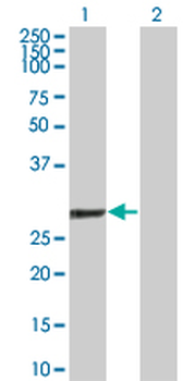 GSTO1 polyclonal antibody (A01)