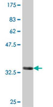 GSTO1 polyclonal antibody (A01)