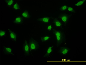 CRSP6 monoclonal antibody (M02), clone 1B5
