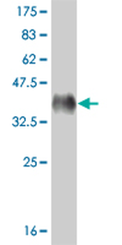 CRSP6 monoclonal antibody (M02), clone 1B5