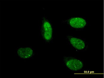 CRSP6 monoclonal antibody (M01), clone 4D4