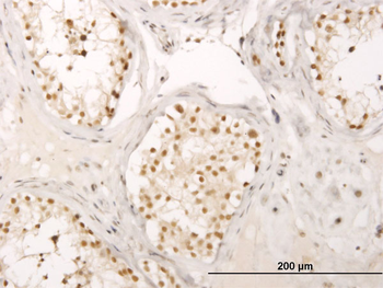 CRSP6 monoclonal antibody (M01), clone 4D4