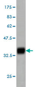 CRSP6 monoclonal antibody (M01), clone 4D4