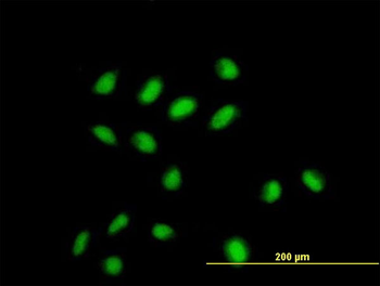 CDYL monoclonal antibody (M02), clone 1A6