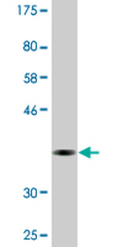 CDYL monoclonal antibody (M02), clone 1A6