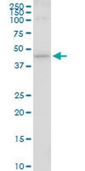HS6ST1 monoclonal antibody (M05A), clone 1H4
