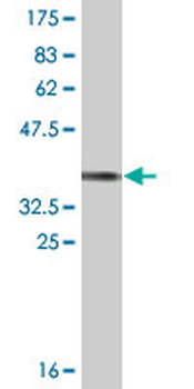 HS6ST1 monoclonal antibody (M05A), clone 1H4