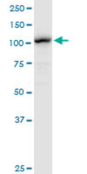 LONP1 purified MaxPab rabbit polyclonal antibody (D01P)