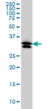 TXNL1 monoclonal antibody (M01), clone 1A10