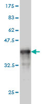 TXNL1 monoclonal antibody (M01), clone 1A10