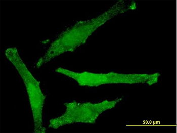 SNAP29 monoclonal antibody (M01), clone 3E4-E6