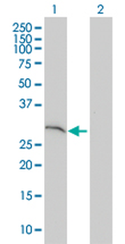SNAP29 monoclonal antibody (M01), clone 3E4-E6