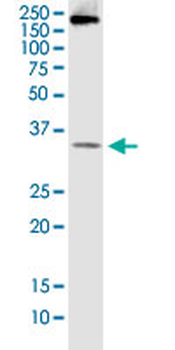 BCL7B monoclonal antibody (M01), clone 6D2