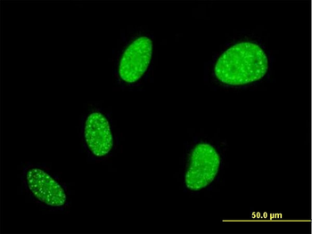 BCL7B monoclonal antibody (M01), clone 6D2