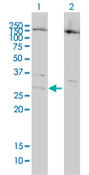 BCL7B monoclonal antibody (M01), clone 6D2