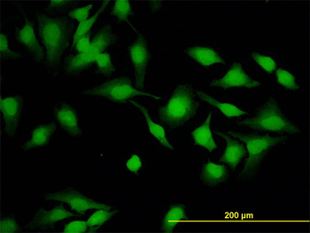 CYTH2 monoclonal antibody (M02), clone 6H5