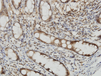 CYTH2 monoclonal antibody (M02), clone 6H5