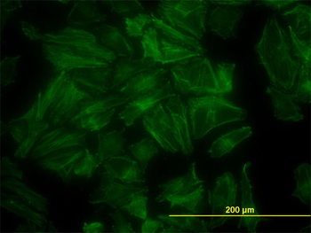 PDLIM7 monoclonal antibody (M01), clone 2D6