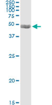 PDLIM7 monoclonal antibody (M01), clone 2D6