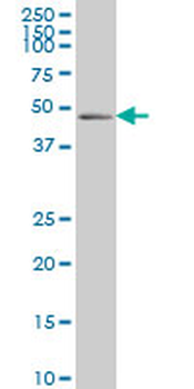 PDLIM7 monoclonal antibody (M01), clone 2D6
