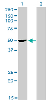 PDLIM7 monoclonal antibody (M01), clone 2D6
