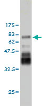 PDLIM7 monoclonal antibody (M01), clone 2D6