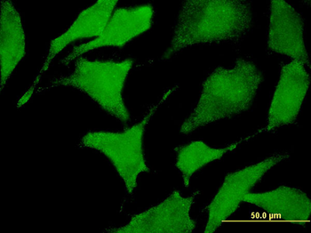 CACNA2D2 monoclonal antibody (M12), clone 4E3