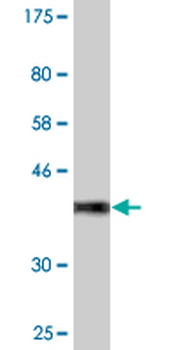 CACNA2D2 monoclonal antibody (M12), clone 4E3