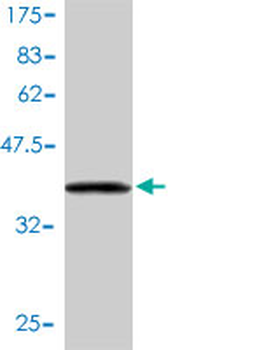 UBE2L6 monoclonal antibody (M01), clone 2F12-1F4