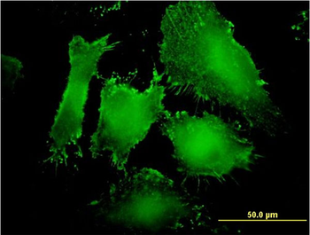 MAGI1 monoclonal antibody (M03), clone 7B4
