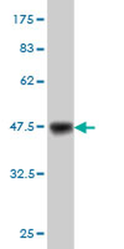 MAGI1 monoclonal antibody (M03), clone 7B4