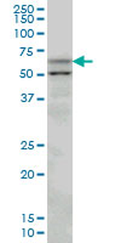 SLC33A1 monoclonal antibody (M07), clone 3A4
