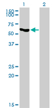 SLC33A1 monoclonal antibody (M07), clone 3A4