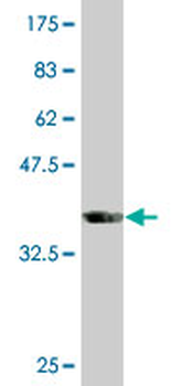 SLC33A1 monoclonal antibody (M07), clone 3A4