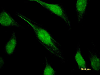 CTDP1 monoclonal antibody (M04), clone 3G4