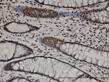 CTDP1 monoclonal antibody (M04), clone 3G4