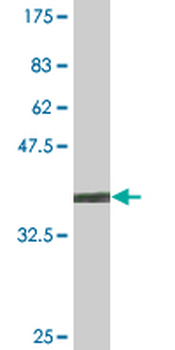 CTDP1 monoclonal antibody (M04), clone 3G4