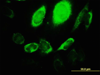 ARHGEF1 monoclonal antibody (M03), clone 4C4