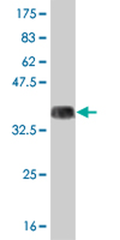 ARHGEF1 monoclonal antibody (M03), clone 4C4