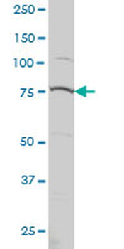 PRPF3 monoclonal antibody (M01), clone 3H6