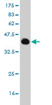 PRPF3 monoclonal antibody (M01), clone 3H6