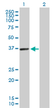 PDLIM1 purified MaxPab rabbit polyclonal antibody (D01P)