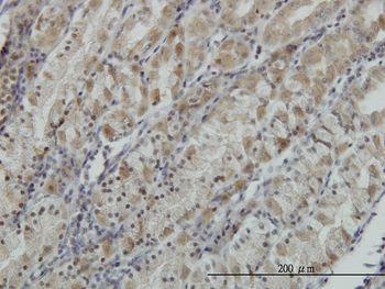 ATP6V0D1 monoclonal antibody (M01), clone 2G12
