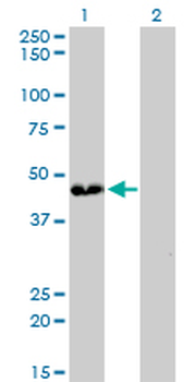 ATP6V0D1 monoclonal antibody (M01), clone 2G12