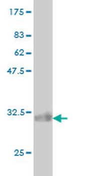 ATP6V0D1 monoclonal antibody (M01), clone 2G12